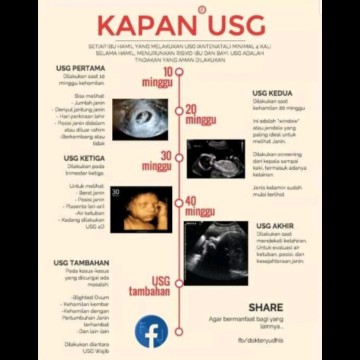 usg minimal 4x selama kehamilan