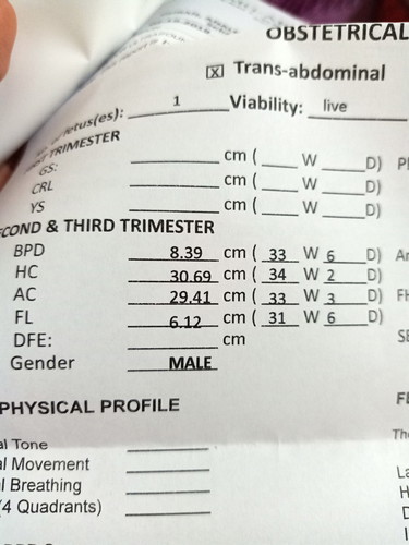 33 weeks measurement