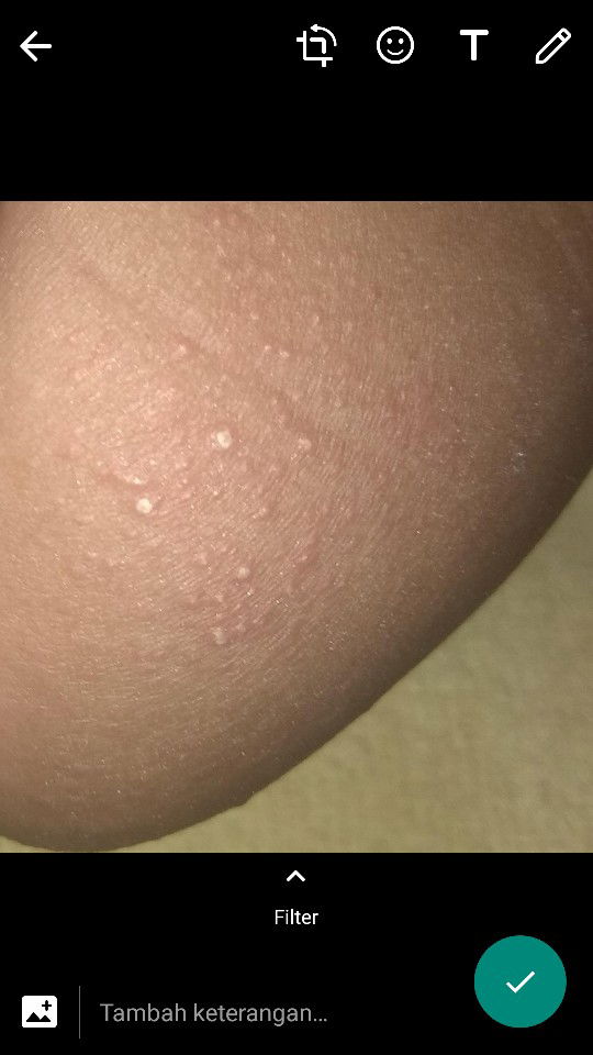 maaf kalau fotonya tidak pantas, saya ingin bertanya?