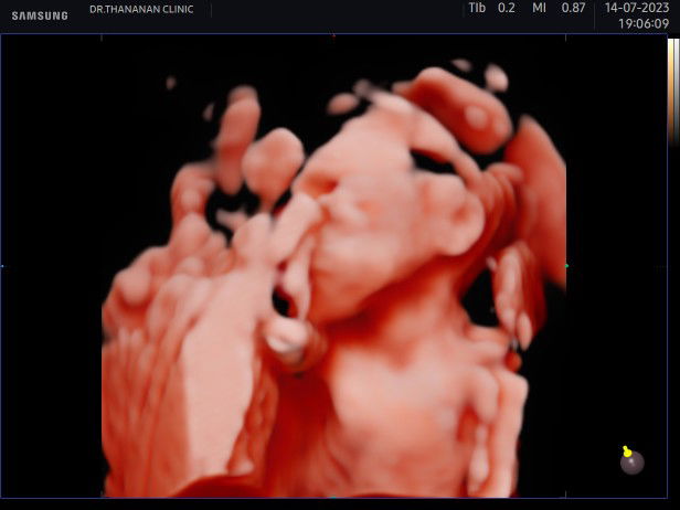 สุดารัตน์ ศรีวิเศษ profile icon