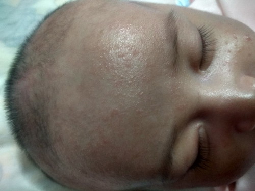 kulit bayi