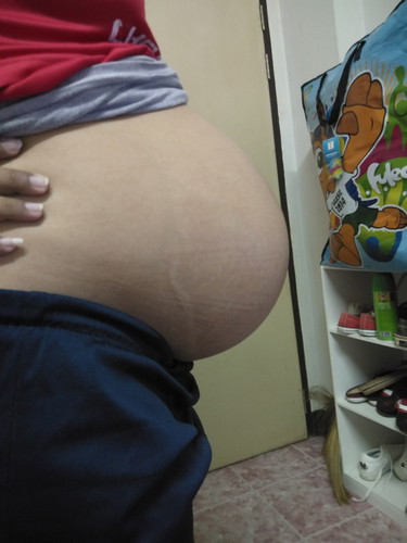 28W