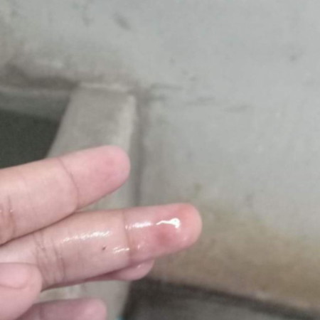 ท้อง15+6วีค