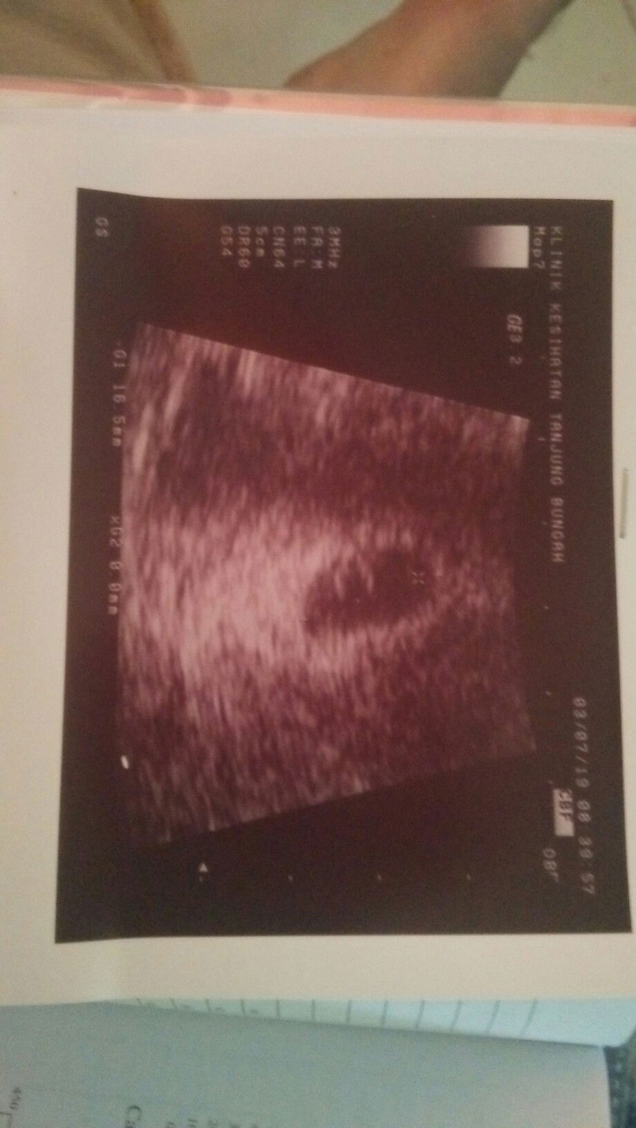 Small fresh blood stain