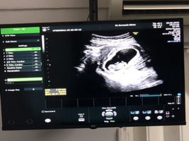 Praewpan Chanchiew profile icon