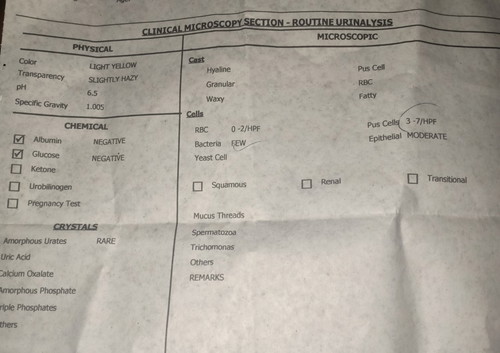 urinalysis
