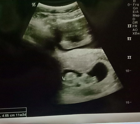 11Week3 Days