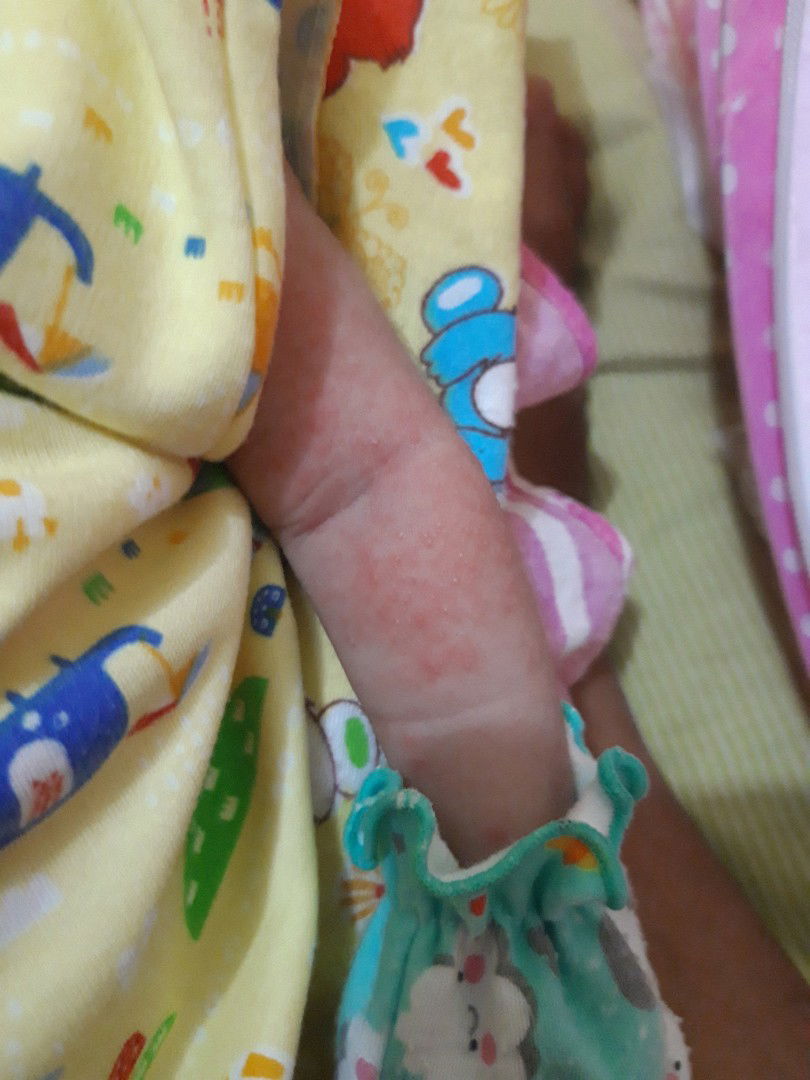 bntu jawab yg sdh pngalaman