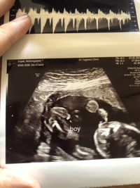 Wathanyapass Sripetch profile icon