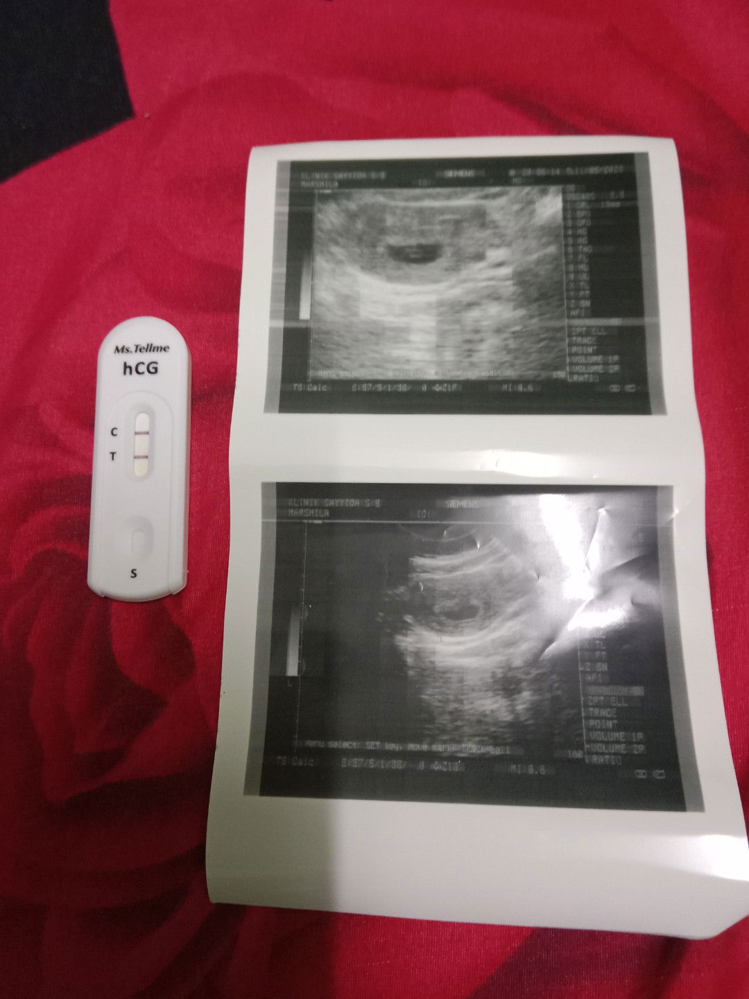 S.Normarshila profile icon