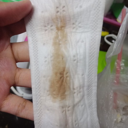 mucus plug?