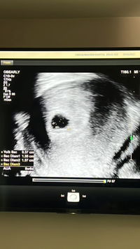 Babyblue profile icon