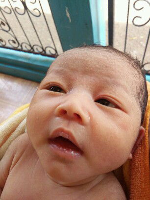 mulut putih pd bayi