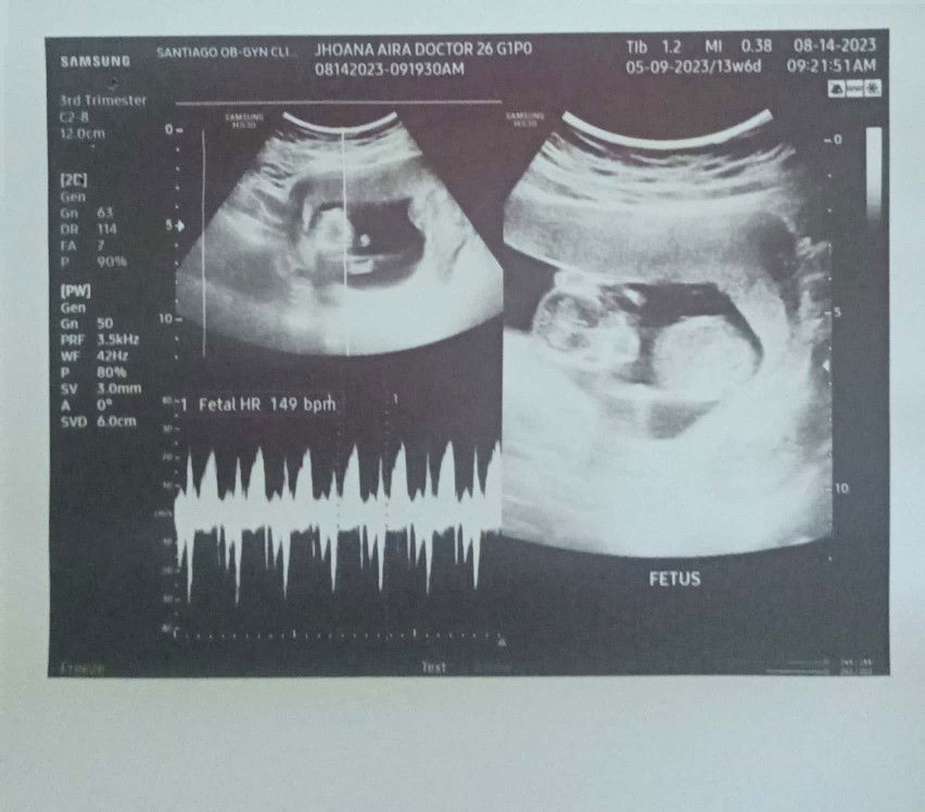 Jhoana Aira profile icon