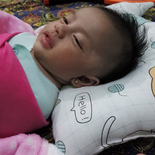 bercak pitih pada wajah