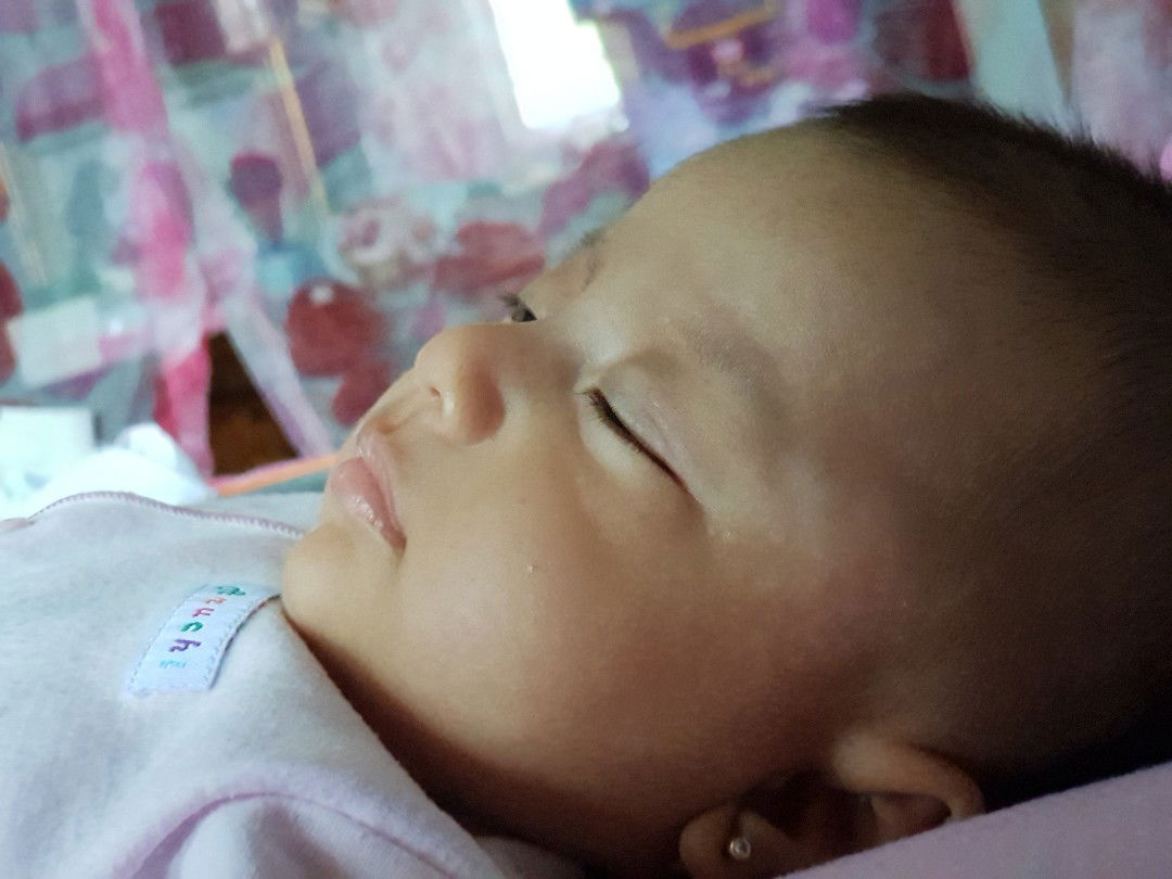 bercak putih pada wajah