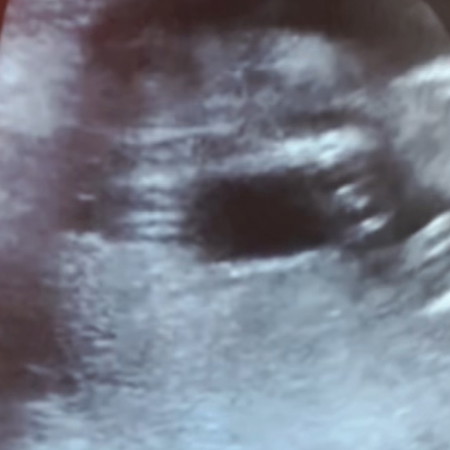 น้องผู้หญิงหรือผู้ชายคะ