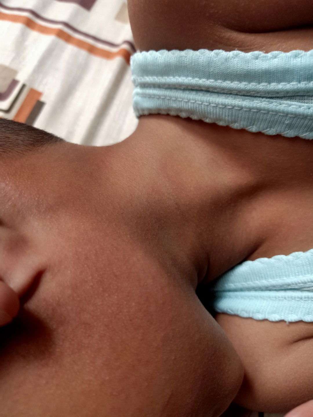 bintik halus pada anak