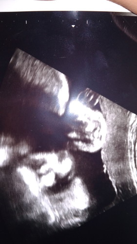 Kira* Baby Aku Boy Or Girl Ya?