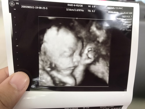 น้ำหนัก