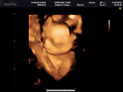 เอารูปลูกมาอวดกันค่ะ