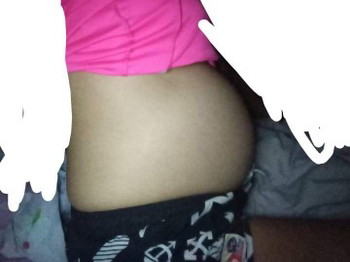 ท้องได้31w+5 มีแต่คนบอกว่าท้องเล้กมากค่ะ