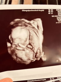 แม่น้องตรัยคุณ profile icon