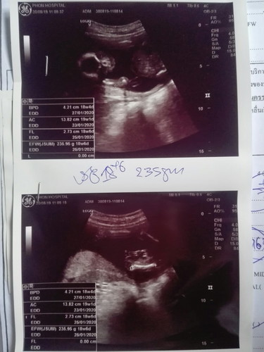 ได้ลูกสาว?