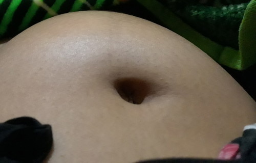 Perut menonjol sebelah