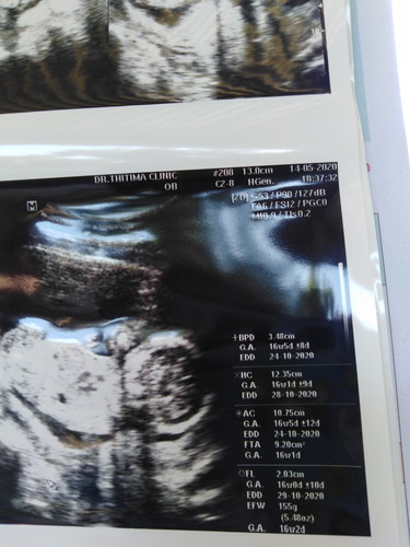 ช่วยอธิบายค่าแต่ละอย่างหน่อยได้ไหมคะ