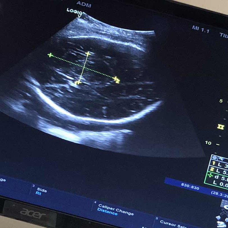 Scan kepala kandungan