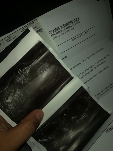 early pregnancy