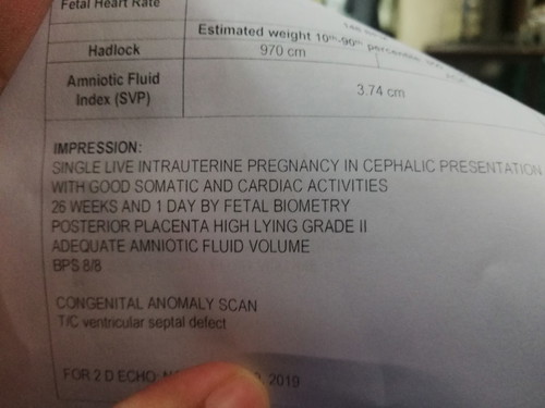VENTRICULAR SEPTAL DEFECT