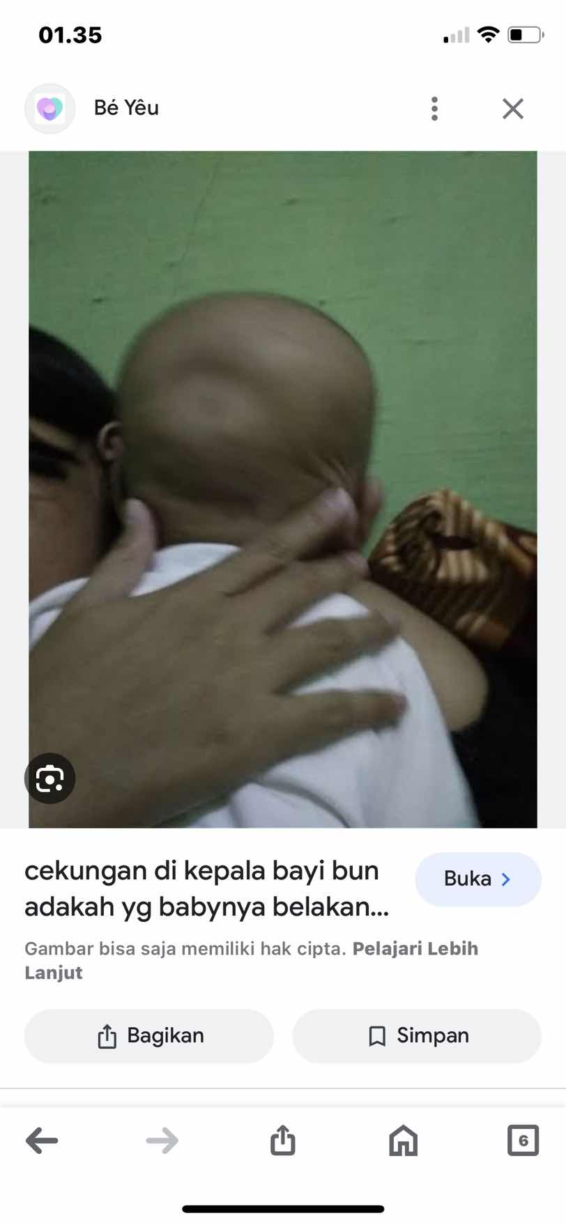 Kepala bagian belakang bayi ada cekungan