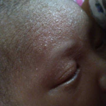 Bayi Brintisan Berair