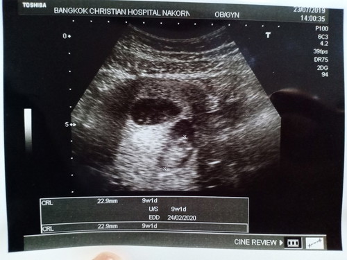 สอบถามแม่ๆหน่อยค่ะ