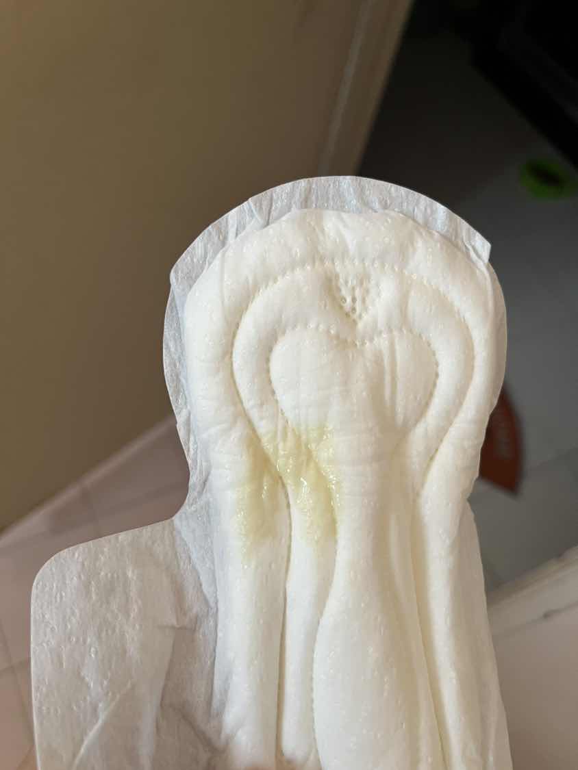 Keluar macam milky discharge dkt panty yang menitis.