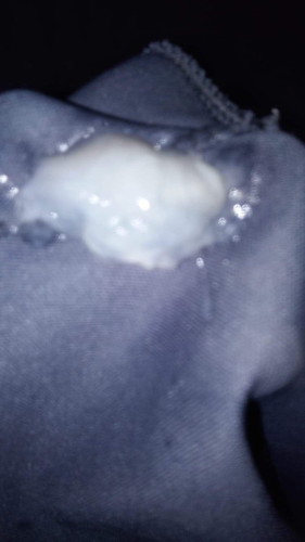 มูกแบบนี้ต้องไปโรงบาลป่าว