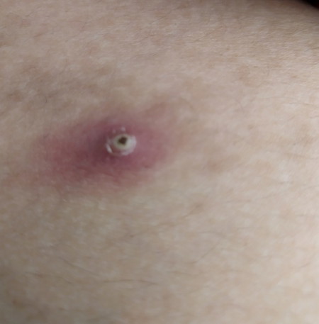 ada yg pernah juga bun?