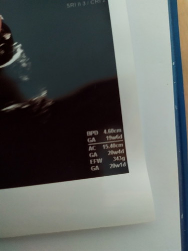 GA yg benar yg mana bun?