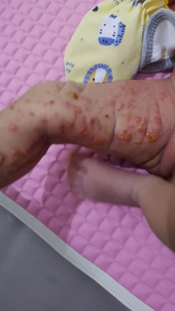 Mohon Doa Utk Kesembuhan Baby Samara