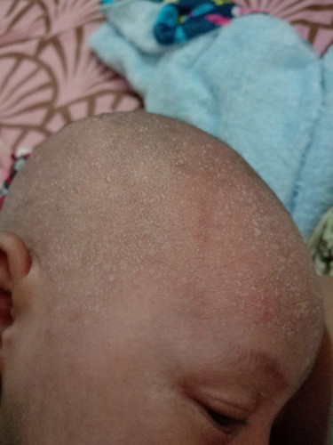 bayi 11hari