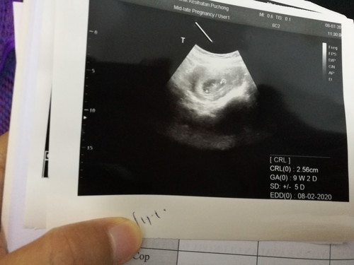 Scan Baby