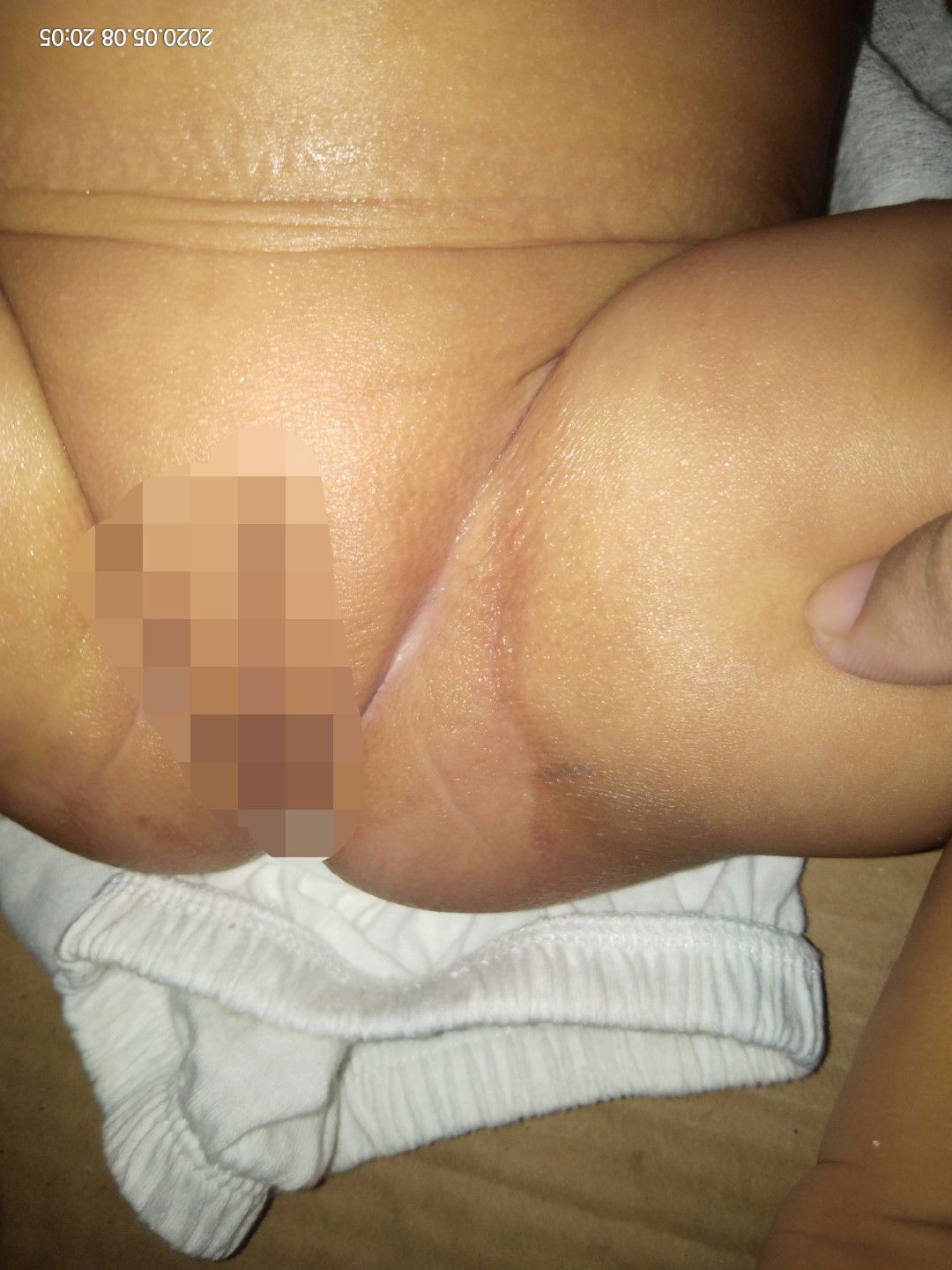 dry skin or natural lang po to?