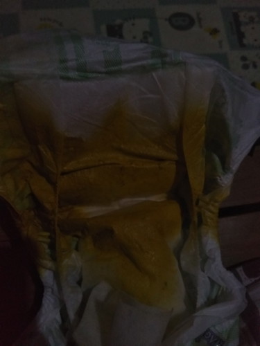tubig poop ng baby quh