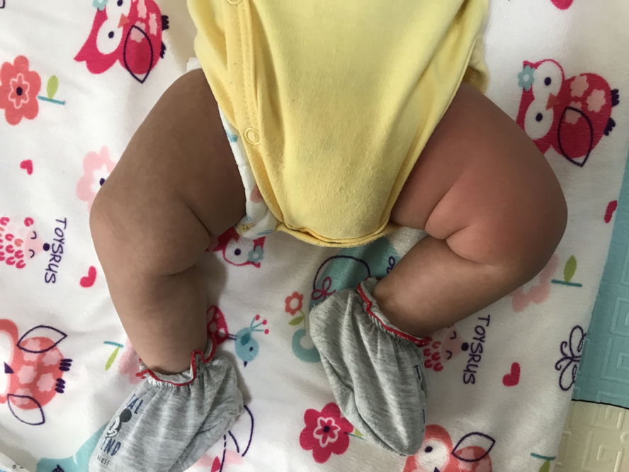 วัคซีน2เดือน