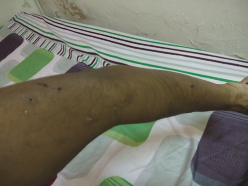 symptoms of pregnancy