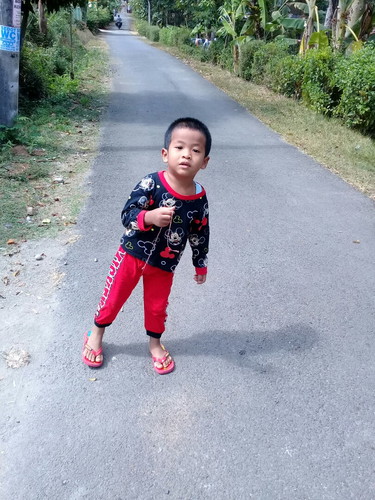 anaku terlambat berbicara