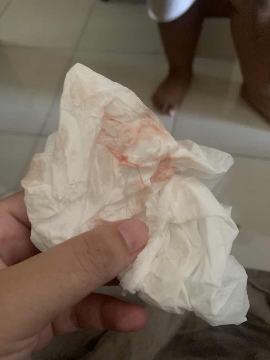 Flex di usia kandungan 36 minggu