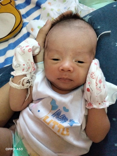 น้องได้17วัน แม่ๆว่าน้องตาเหล่มั้ยค่ะ แล้วจะปกติมั้ยค่ะ